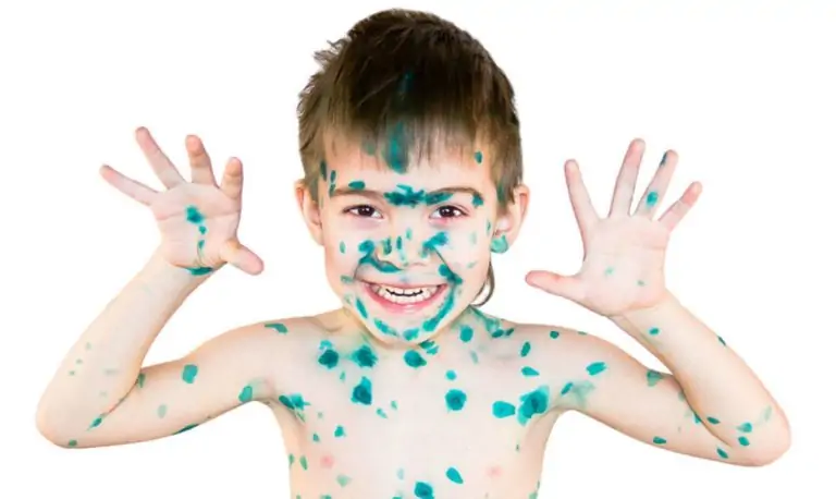 Тест: Что ты знаешь о зеленке?