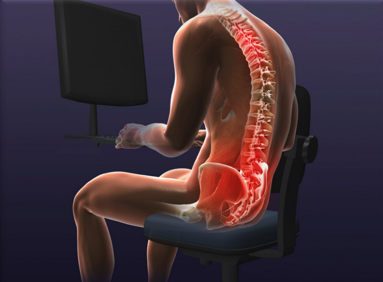 Тест по медицине: что вы знаете о нагрузке на позвоночник?
