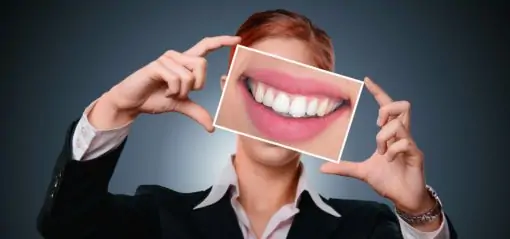 Не пора ли вам обратиться к стоматологу? Тест о здоровье зубов и десен подскажет ответ