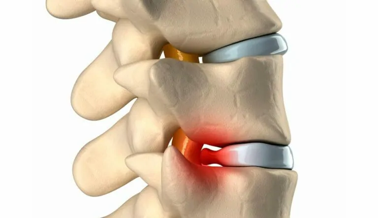Тест по медицине: Что вы знаете о блокаде позвоночника?