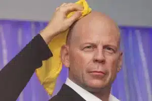 Каковы ваши шансы облысеть?