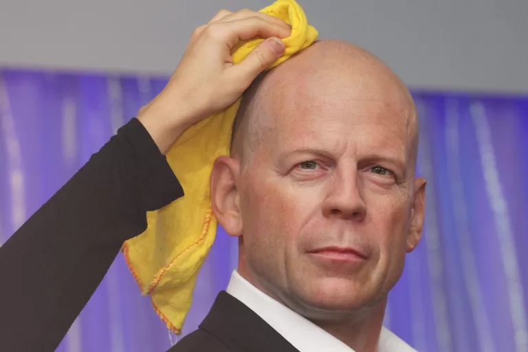 Каковы ваши шансы облысеть?